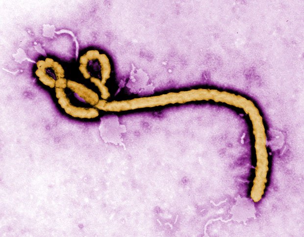 電子顕微鏡でみたエボラウイルス。フレデリック・マーフィー博士撮影。米疾病対策センター（ＣＤＣ）提供
<br />