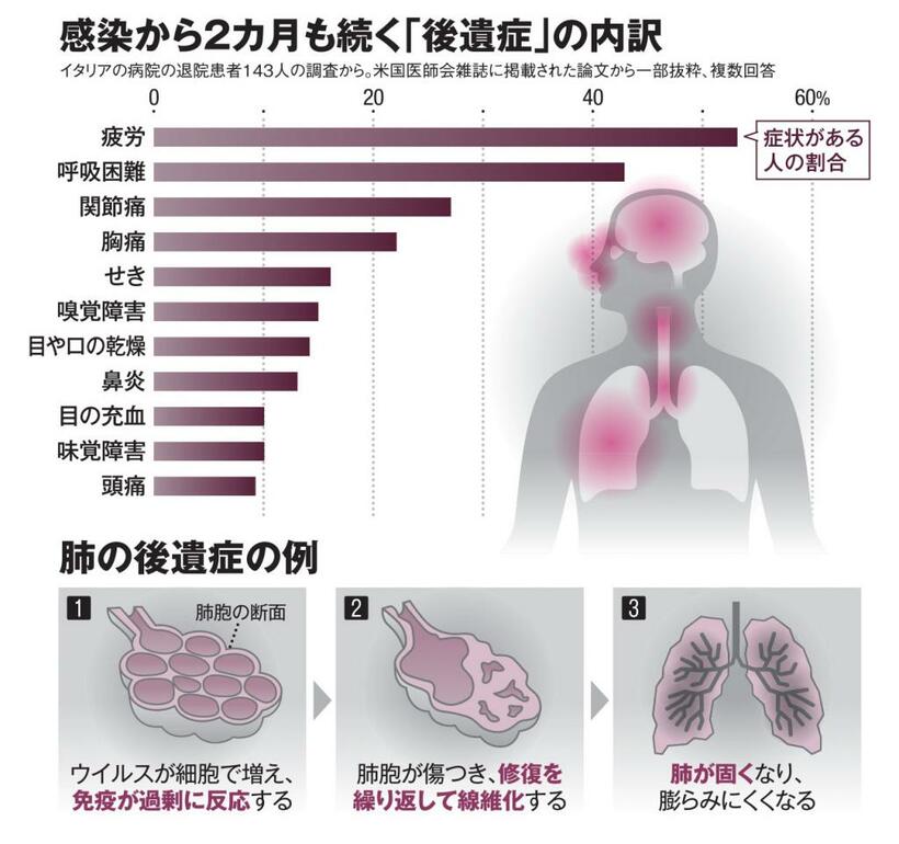 ＡＥＲＡ　２０２０年９月７日号より