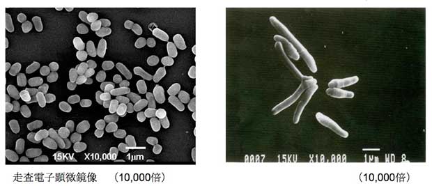 電子顕微鏡で見たコリネバクテリウム・ウルセランス菌（１万倍）。ジフテリア菌と同じ仲間で、予防にはジフテリアの予防接種（ワクチン）も有効だと考えられている（国立感染症研究所提供）
