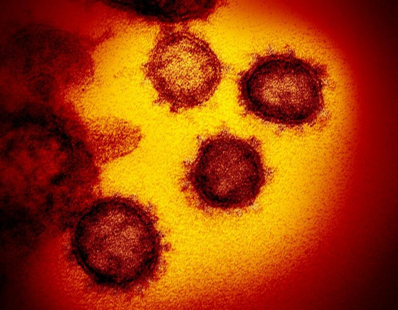 電子顕微鏡で見た新型コロナウイルス＝米国立アレルギー・感染症研究所提供(C)朝日新聞社