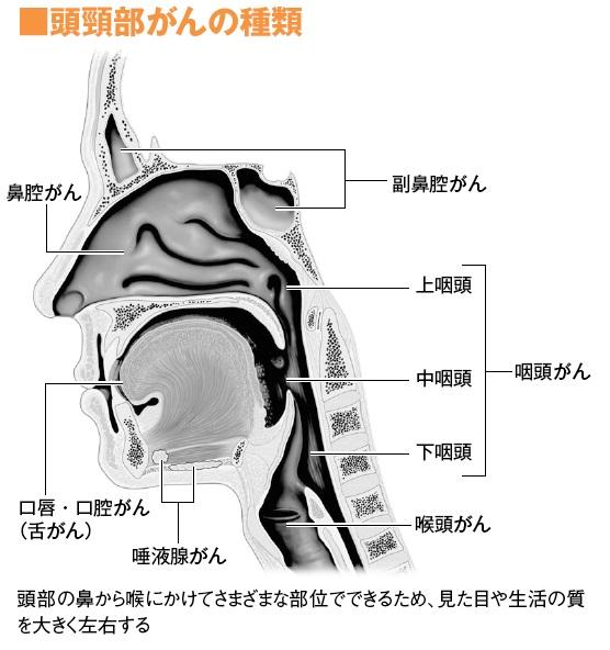 頭頸部がんの種類
