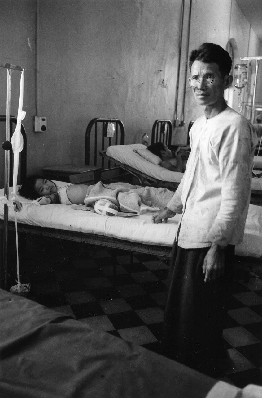 ベトナム戦争の戦禍で右手と右足を失った少女。カントーの病院で撮影。父親は写真でみんなに伝えてほしいと、傷を見せた(1966年、石川文洋さん撮影)