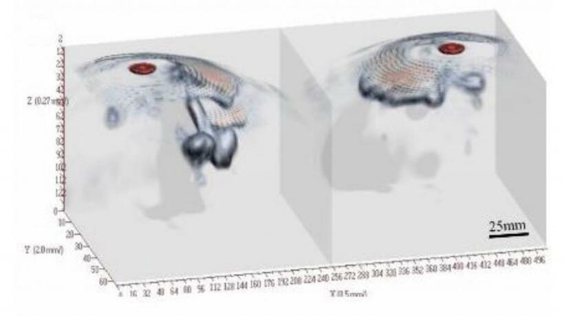 同じ患者の乳房をマイクロ波マンモグラフィーで撮影した3D画像。左右ともにがんの位置や形が３次元でくっきりと映し出されている（写真：木村建次郎研究室提供）