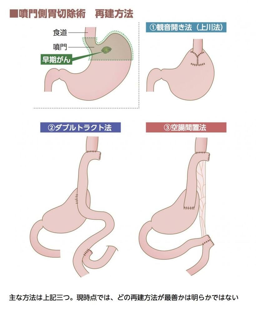 （イラスト／寺平京子）