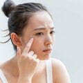 顔に湿疹、ニキビに「化粧はやめといたほうがいいですよね?」 皮膚科医・大塚篤司医師の答えは?