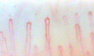 見た目年齢は「毛細血管」の状態に比例する 老化の大敵「ゴースト血管」退治法