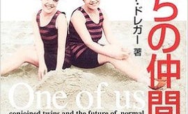結合双生児の「分離されたくない」という気持ち、その背景にあるものとは