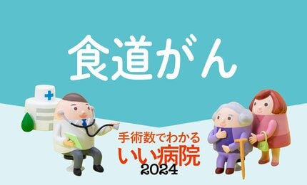 食道がん手術数】病院ランキング2024年版・全国トップ40 1位は国がん中央病院、2位は国がん東病院 | AERA dot. (アエラドット)