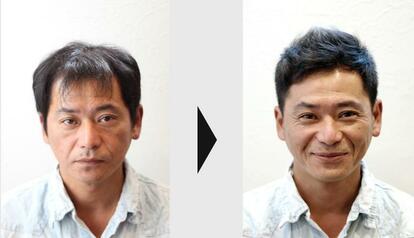 【写真1】M字タイプのヘアスタイル例(INTIのホームページから)