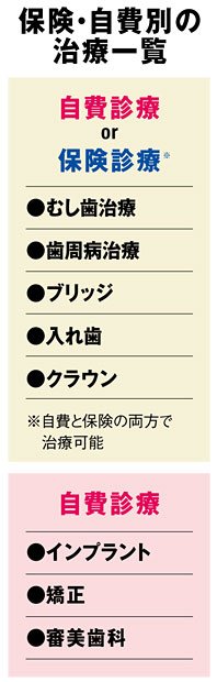 1ページ目)治療費の謎を解け！ 歯科医師が明かす“自費診療”と“保険診療