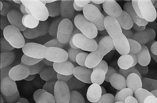 プラズマ乳酸菌はラクトコッカスと呼ばれる球状の小さな菌（写真：キリン提供）