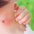 〈夏休みスペシャル〉蚊の活動は猛暑で鈍る 殺虫剤の売り上げは減る? フマキラー、アース製薬の業績を調べてみた