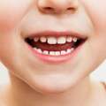 子どもの歯並びが悪い 親が考えるべき矯正歯科治療のタイミングは? あごや顔面の骨格・歯は遺伝する