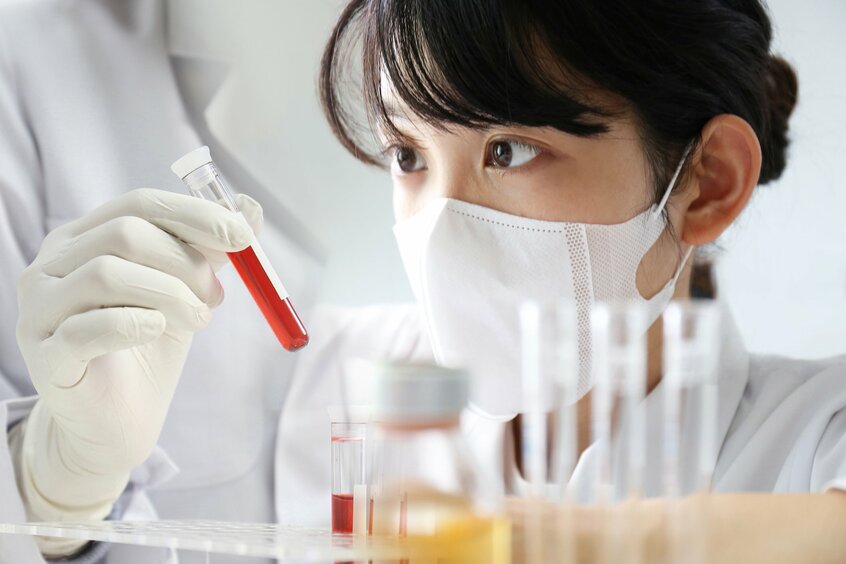 血液検査も定期的に受けるべきです(写真:Getty Images)