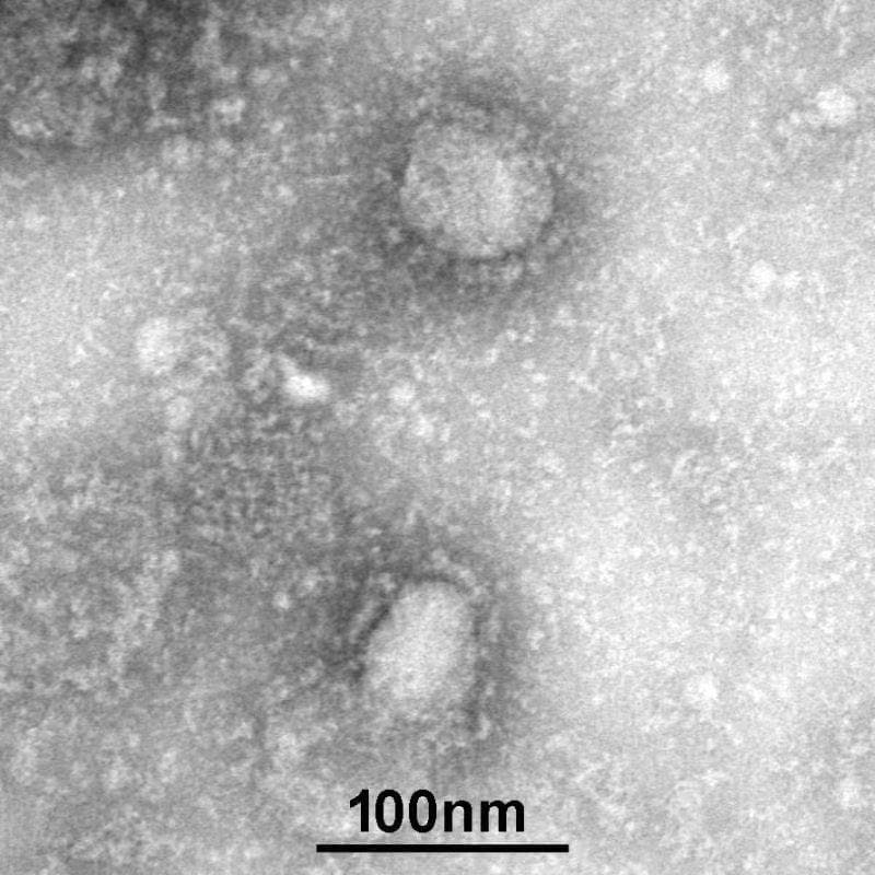 新型コロナウイルスの電子顕微鏡写真　（ｃ）朝日新聞社