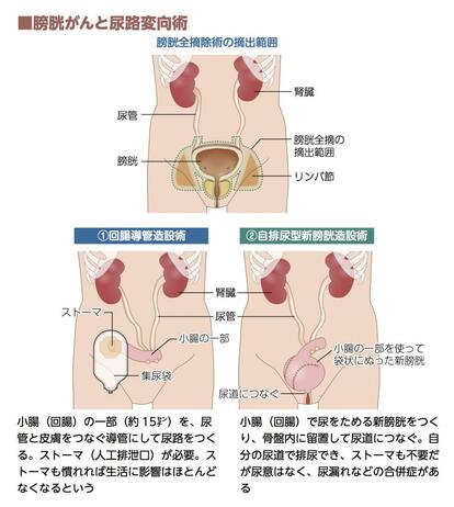 尿路変向・再建術 尿路変向・再建術 (Urologic Surgery Next 5) | 荒井 陽一 |本