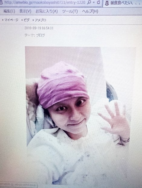 9月19日付のブログで闘病中の写真を公開した小林麻央
