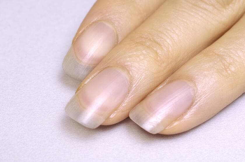 嶋田さんの指先。ほんのりと桜色の爪で、先端は透明。地爪の美しさが際立っている　（写真：育爪サロン「ラメリック」提供）