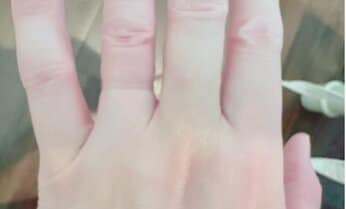 私の入院が足の不自由な息子の自立のチャンスに 障害児を育てる親が入院。そのとき家族は?