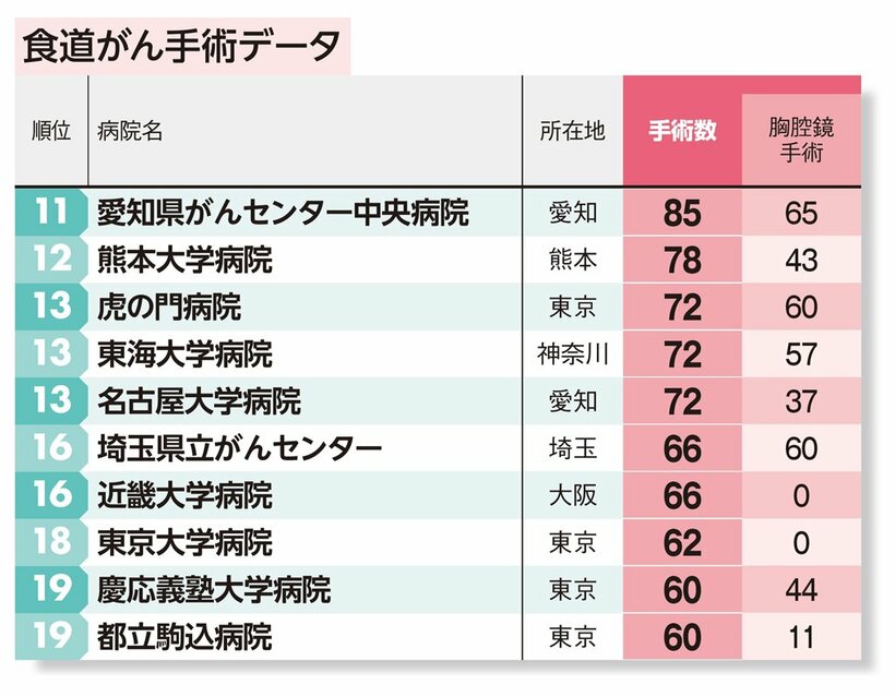 食道がん手術件数の病院ランキング　１１位～１９位