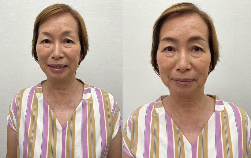 ケア前（左）ケア後（右）