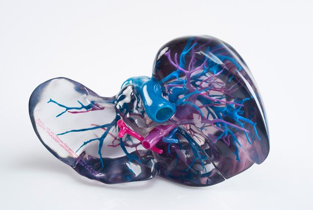 複数の色の素材を組み合わせて作った臓器モデル（写真提供：ストラタシス・ジャパン）