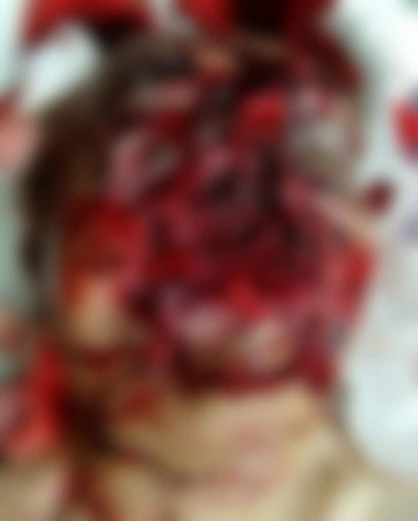秋田市内の畑でクマの襲われた80代の男性。ほぼ顔がなくなっているように見える＝秋田大学医学部付属病院提供
