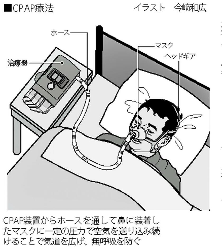 CPAP療法