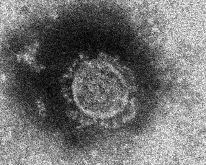 新型コロナウイルスの電子顕微鏡写真＝国立感染症研究所提供　（ｃ）朝日新聞社