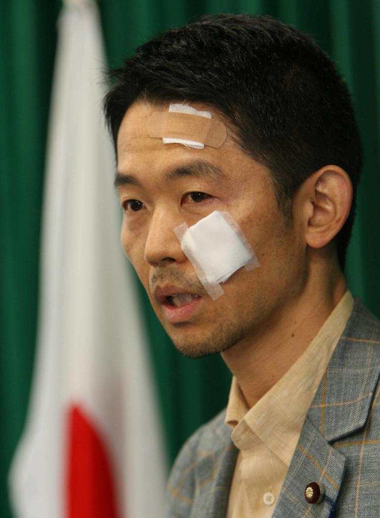 顔にガーゼを張り、閣議後の記者会見にのぞんだ赤城農水相(当時)