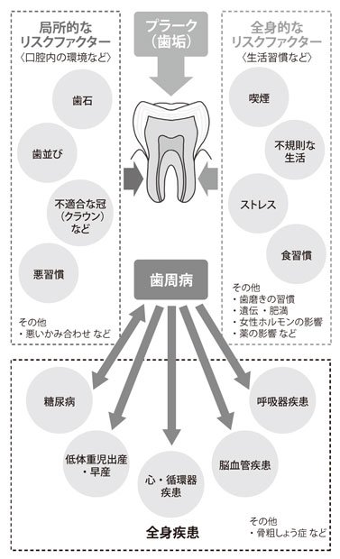 歯周病と関係する全身疾患（『日本人はこうして歯を失っていく』より）