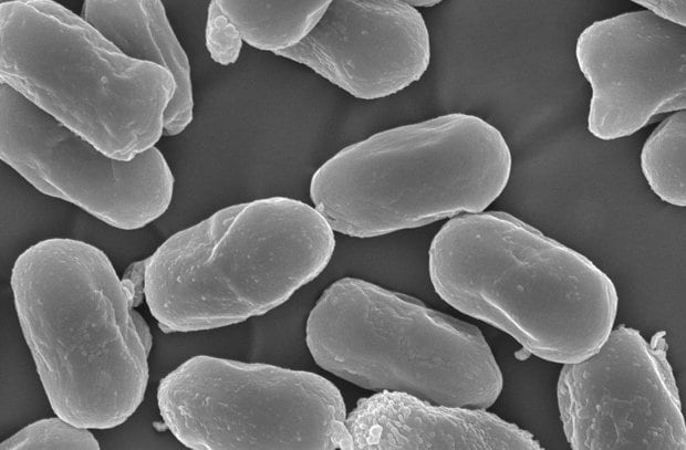 Ｓ－９０３納豆菌の電子顕微鏡写真。納豆菌胞子の状態（写真：タカノフーズ）