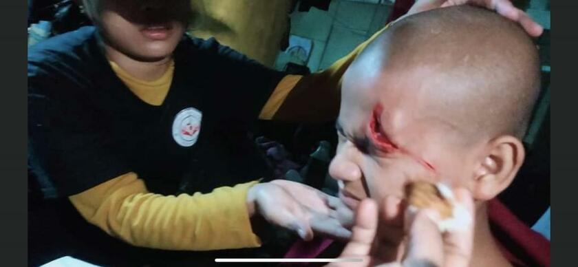 けがをした少年僧が治療を受ける（シットウェ郊外の寺院）