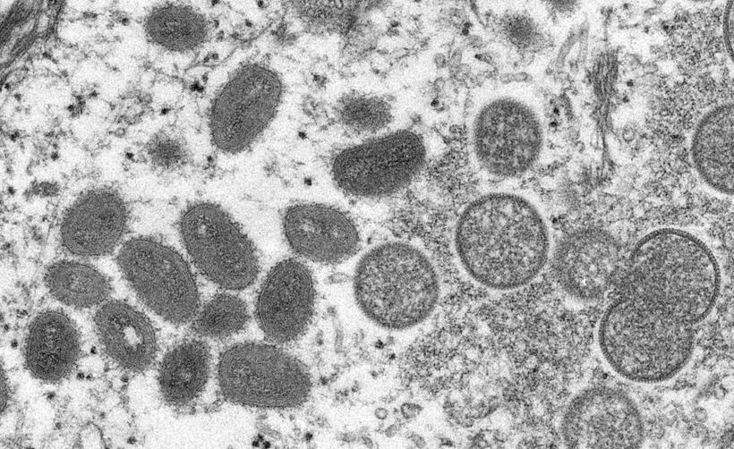 サル痘が流行している。天然痘ウイルスの仲間であるサル痘ウイルスの電子顕微鏡画像（photo　米疾病対策センター（CDC）提供）


