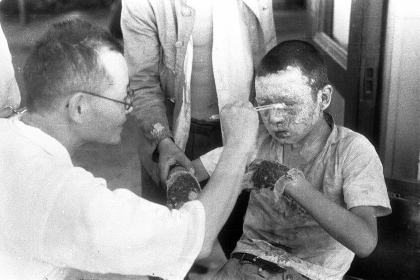 広島赤十字病院でやけどの手当てを受ける少年。のちに画像鑑定で、この少年が原田成男と特定された（撮影：宮武甫）