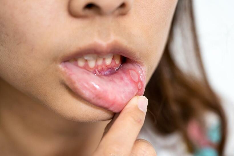 ※写真はイメージです（写真／Getty Images）