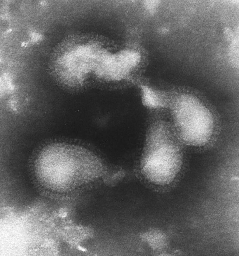 インフルエンザウイルスの電子顕微鏡写真（円内）　（ｃ）朝日新聞社