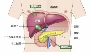 【肝胆膵がん手術】専門医に聞くセカンドオピニオンをとるべきケースは?