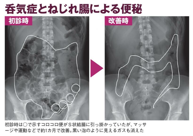 ＡＥＲＡ　２０２１年６月１４日号より（写真：水上健さん提供）