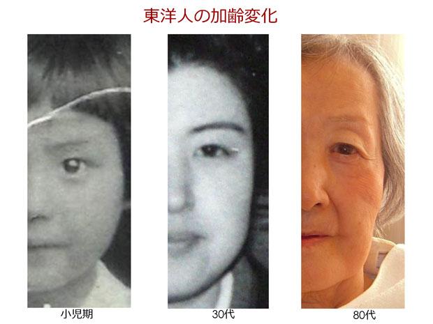 東洋人の加齢変化（小児期～３０代～８０代）を見ると、まぶたの垂れ具合は明らか　（大慈弥裕之医師提供）