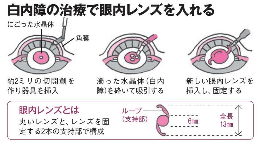 AERA 2021年11月15日号より
