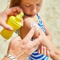 〈この時期に読みたい〉子どもの日焼け、どこまで気にすればいい? 日焼け止めは毎日塗るべき? 専門医に聞く