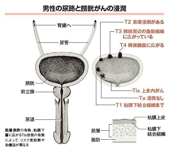 （イラスト／今崎和広）