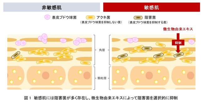 写真・図版(1枚目)| 資生堂、菌叢研究を通じて敏感肌には表皮ブドウ球菌の生育を阻害する特殊なアクネ菌が多いことを発見 ~特殊なアクネ菌を選択的に抑制する効果を微生物由来エキスに発見~
