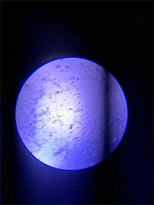 ニワトリの筋細胞の顕微鏡写真。杉崎さんはサークル活動で低コストで鶏肉を培養する研究を進める（写真：杉崎麻友さん提供）