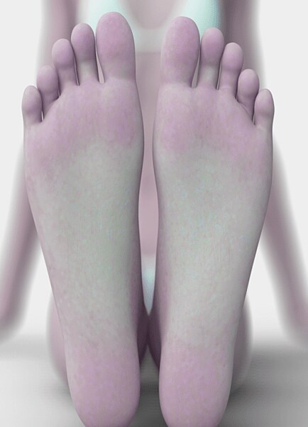 紫ががった色の足裏（イメージ）