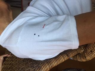 白半袖シャツに開いた2つの穴と、袴田さんの体の傷(赤ライン)の位置