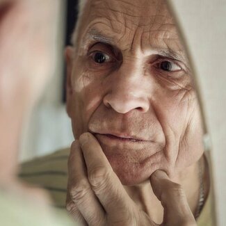 シワ改善につながる予防策を皮膚科医が解説「なぜシワができるのか原因は?」