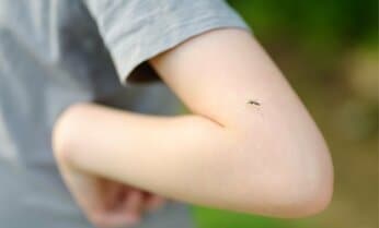 〈夏休みシーズン〉子どもの虫刺され、大人よりはれるのはなぜ? 専門医に聞く、仕組みと対処法