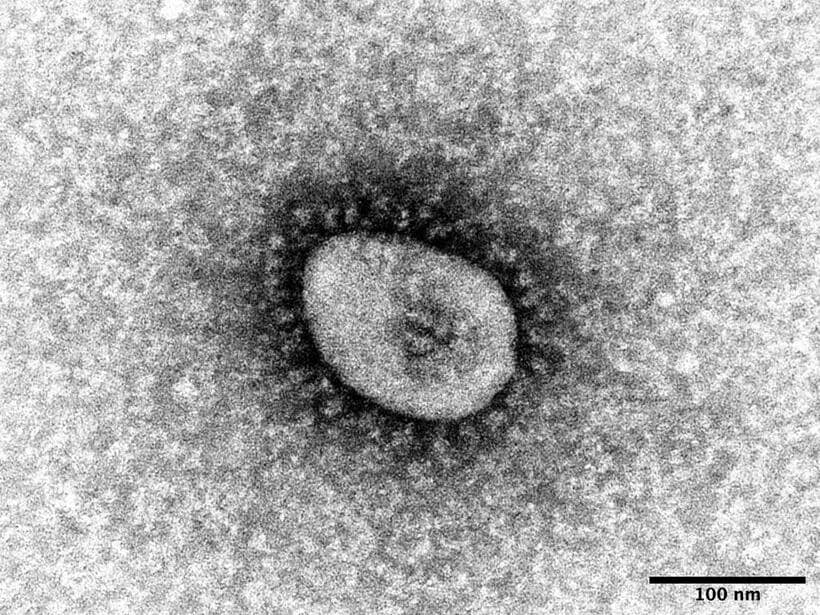 オミクロン株の電子顕微鏡写真（国立感染症研究所）